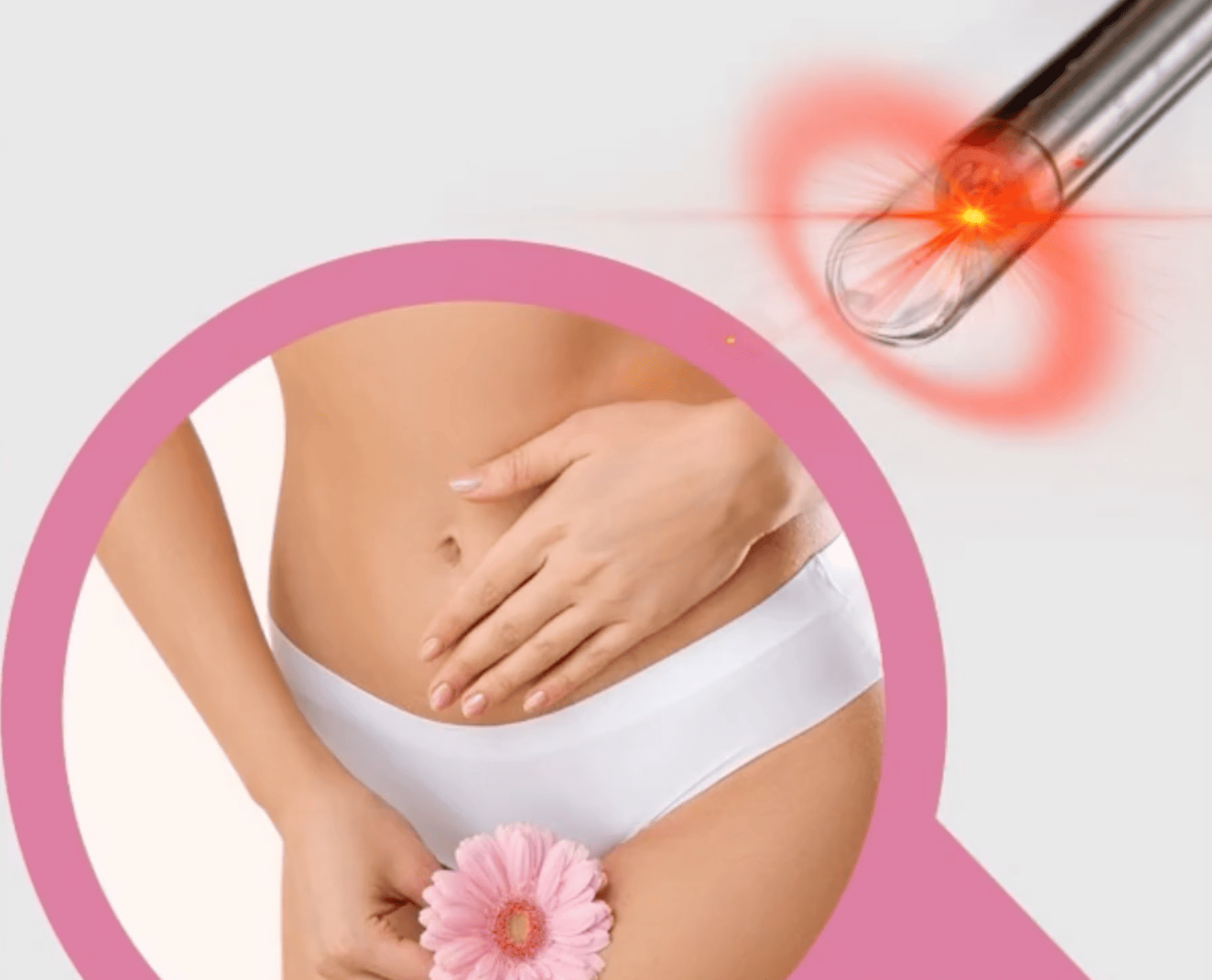ENDO ONE lasertechnologie cosmetische gynaecologie